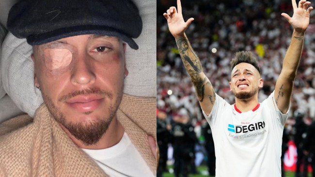 Monterrey-spilleren Lucas Ocampos er lam i ansiktet på grunn av et virus; fansen har det gøy med memes