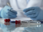 DR Kongos deltakelse i fotball-VM er ikke i fare, til tross for ebolautbruddet
