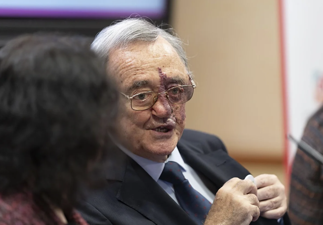 Spanske forskere oppnår fullstendig utryddelse av bukspyttkjertelkreft takket være en kombinasjon av tre legemidler