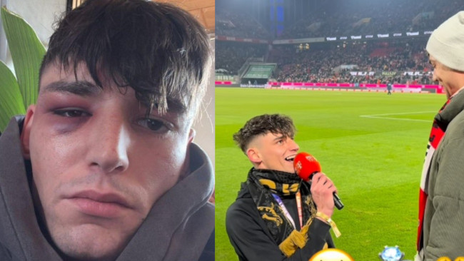 Tysk fotballdommer utsatt for homofobisk angrep få dager etter å ha fridd offentlig til sin forlovede